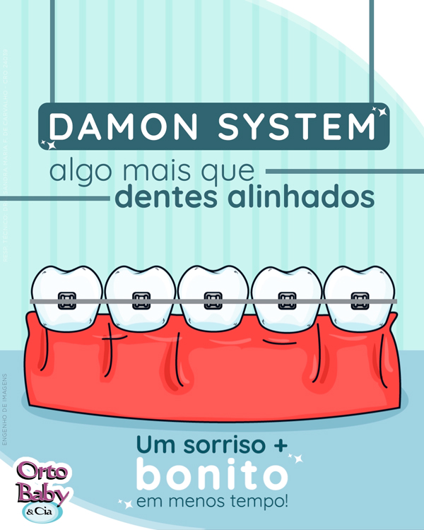 Damon System: algo mais que dentes alinhados
