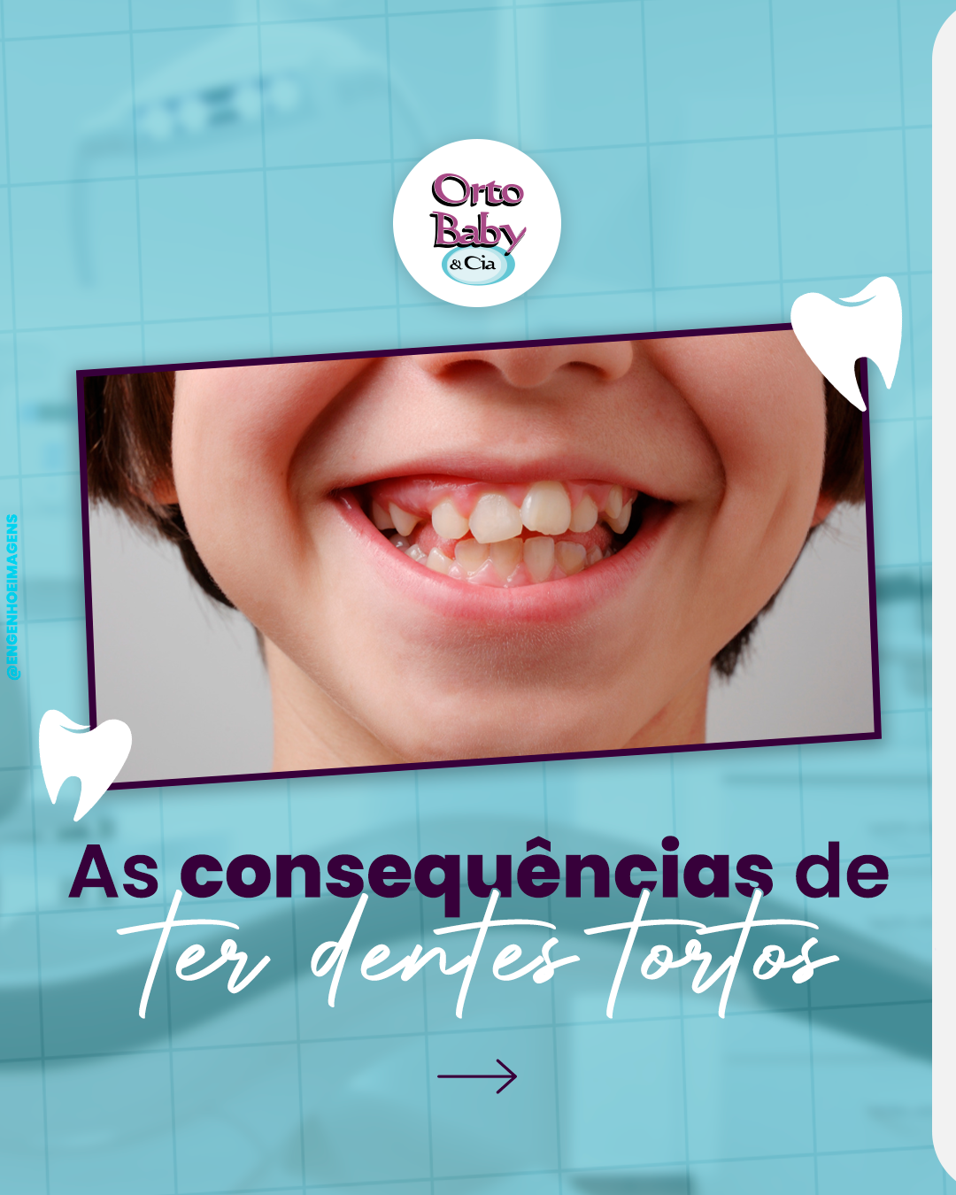 Sorriso Saudável: A Importância do Alinhamento Dental