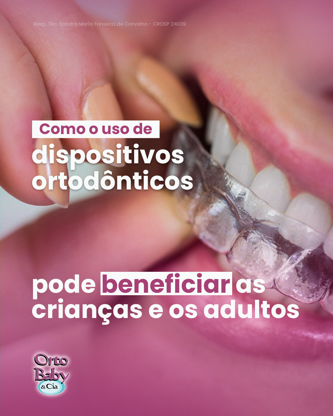 O uso de dispositivos ortodônticos vai muito além da estética! O uso de dispositivos ortodônticos vai muito além da estética!