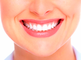 Clareamento dental, a maneira de transformar um sorriso